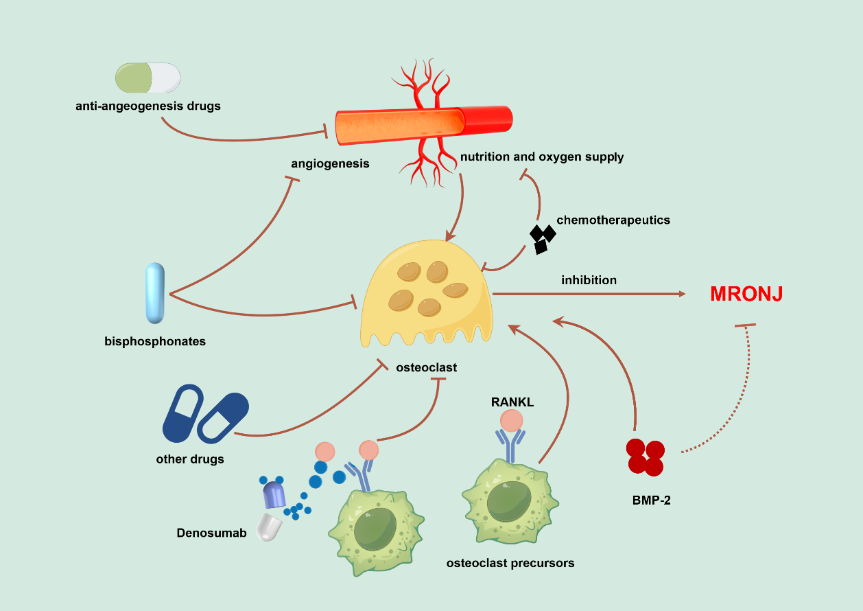 Bisphosphonates, denosumab, angiogenesis inhibitors, chemotherapeutics, and other potential candidates suppress osteoclastogenesis directly or indirectly via various mechanisms, thereby inducing the occurrence of MRONJ. Since BMP-2 has the potential to activate osteoclasts, it is reasonable to assume that high-dose BMP-2 may be beneficial for MRONJ management in the clinic.
